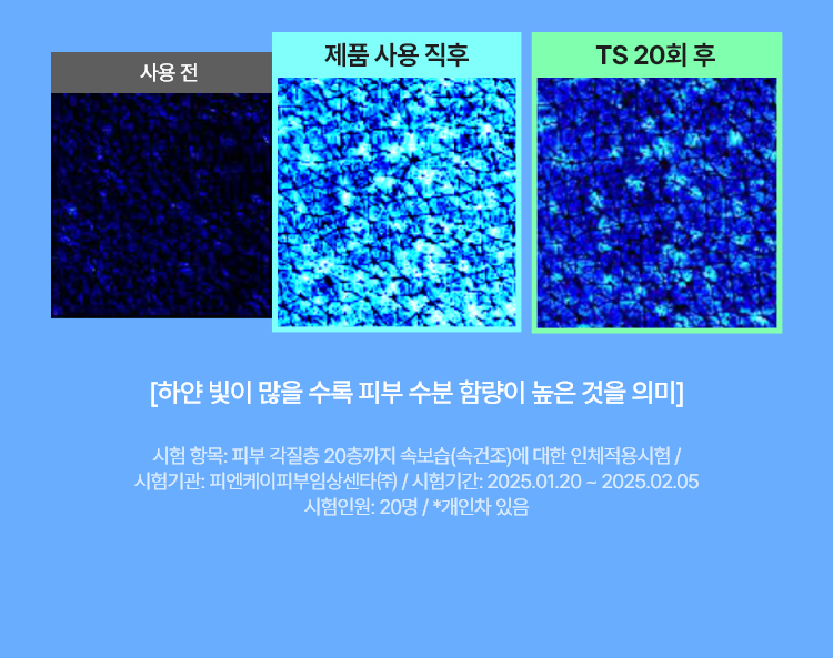하이퍼히알-앰플-750px_07.jpg