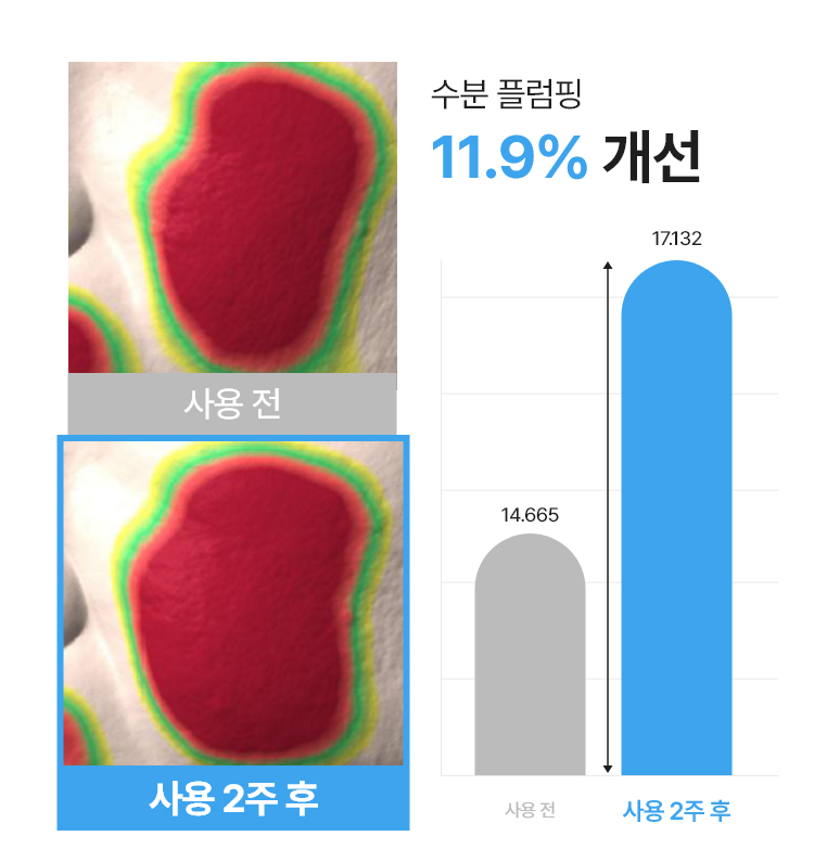 하이퍼히알-앰플-750px_09.jpg