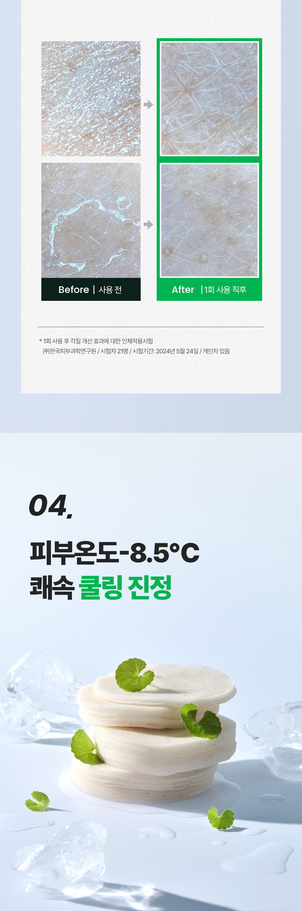 07. 시카좀패드40매_쿨링진정.jpg