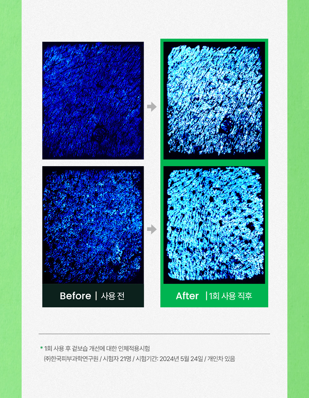 09. 시카좀젤크림100ml_비포애프터.jpg