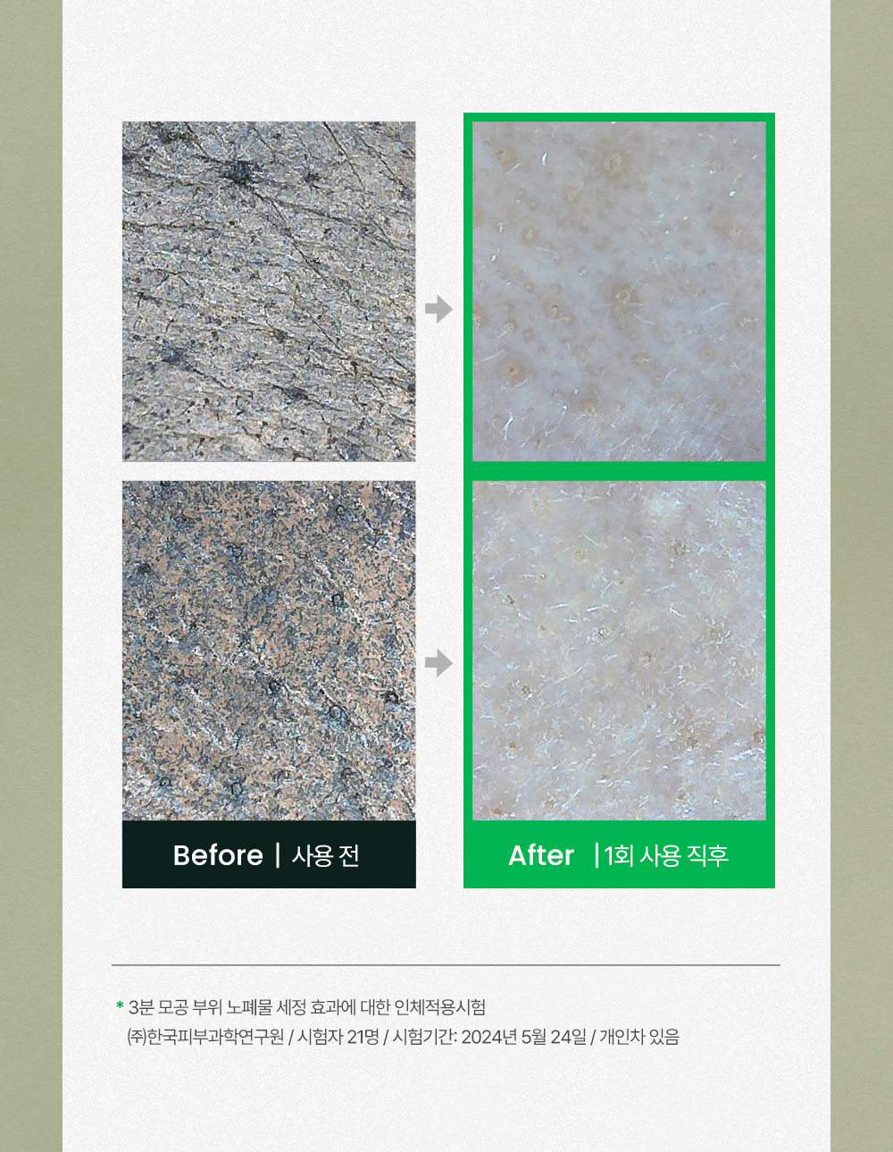 09. 시카좀클렌징폼150ml_비포애프터.jpg