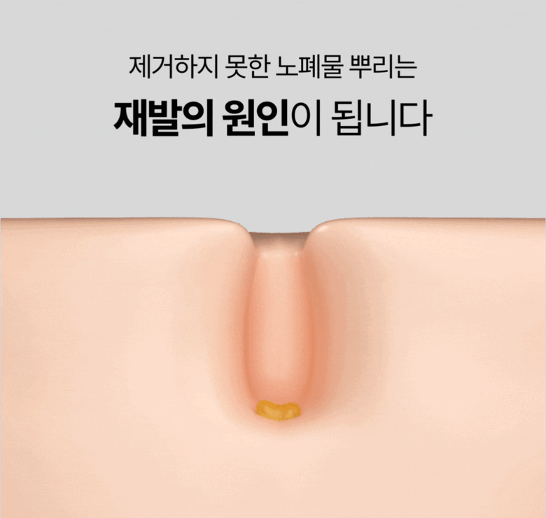 Soonyul_10.gif